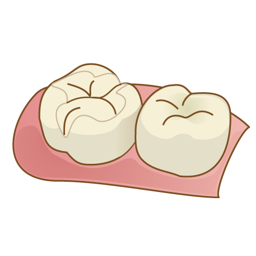 口を大きく開けて笑うことはできますか？