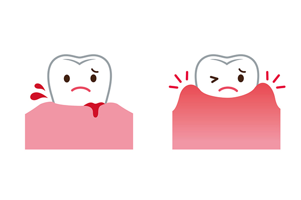 ご自身の歯茎が今どのような状態かご存知ですか？