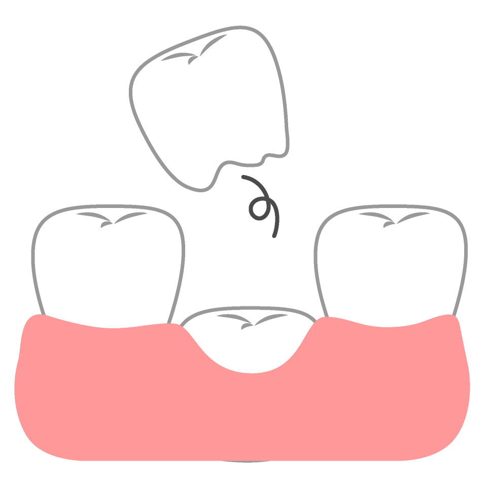 どうして歯は生え変わるの？