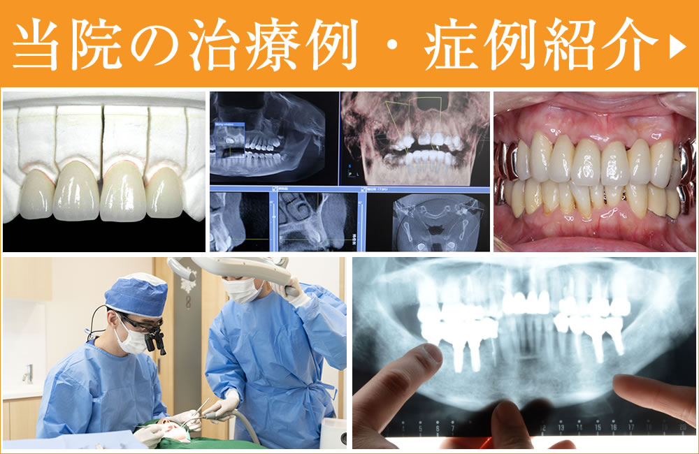 症例・治療例
