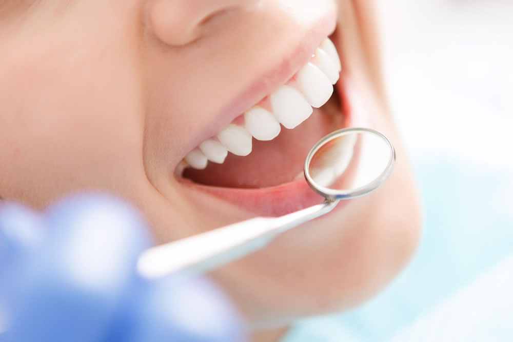 予防歯科の推奨