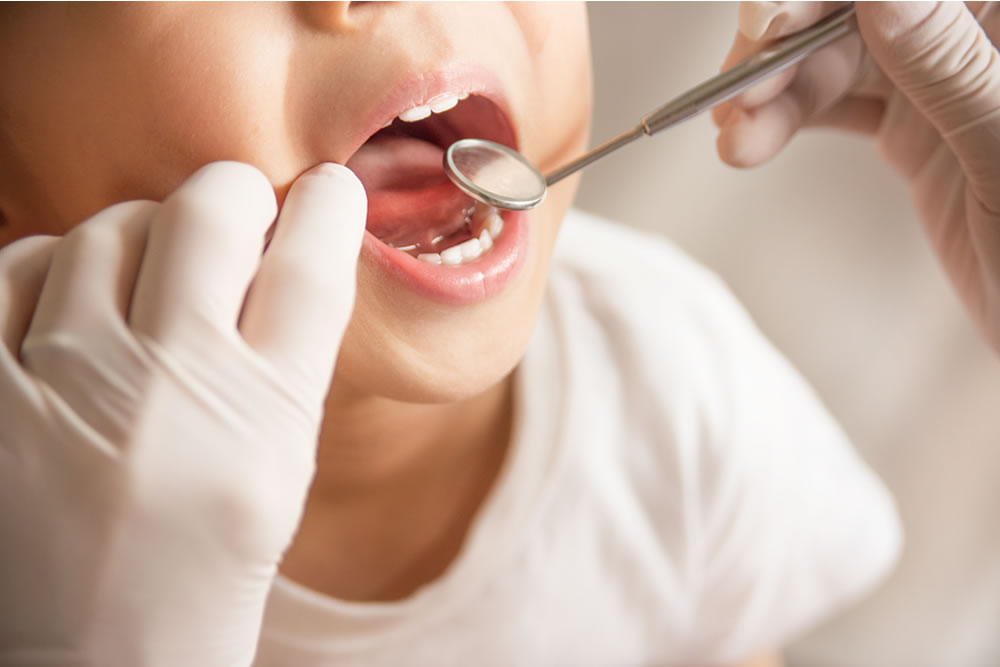 小児歯科を受診する適正年齢