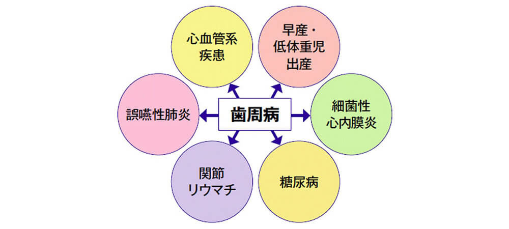 歯周病と全身疾患の関係性