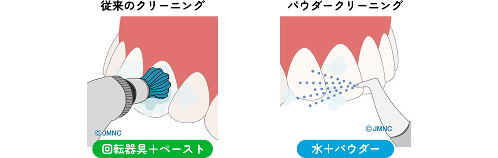 歯を傷つけにくい